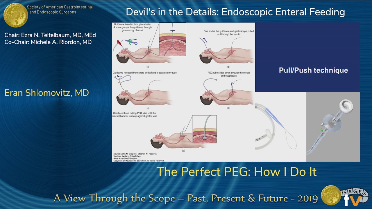 How to use peg - sg？ 5 key tips for beginners