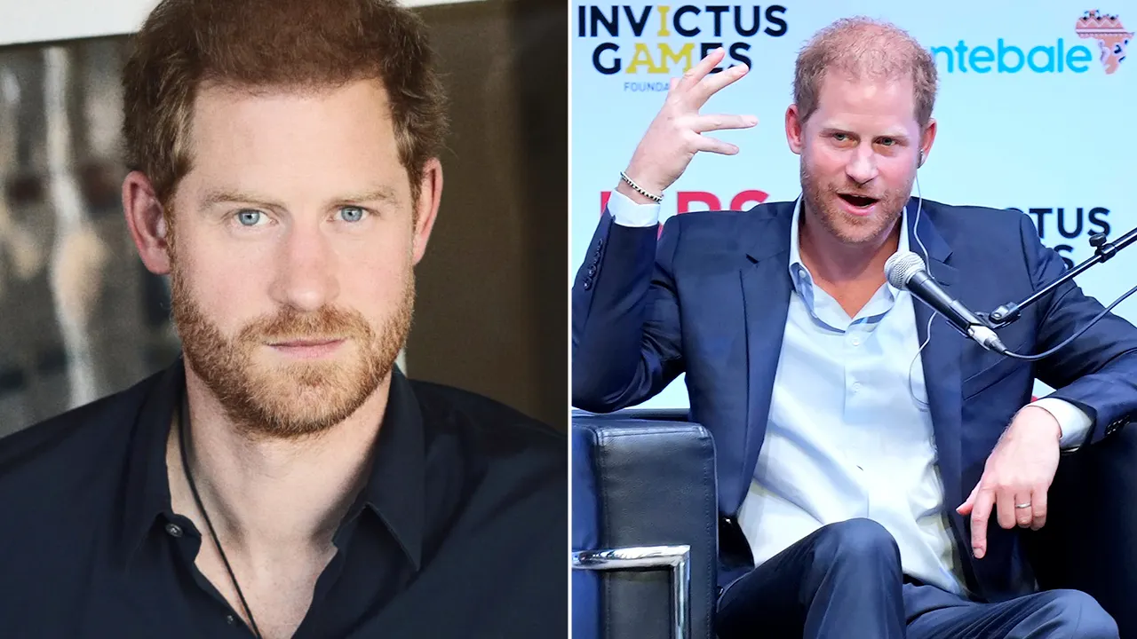 harry baldness:hair loss in harry